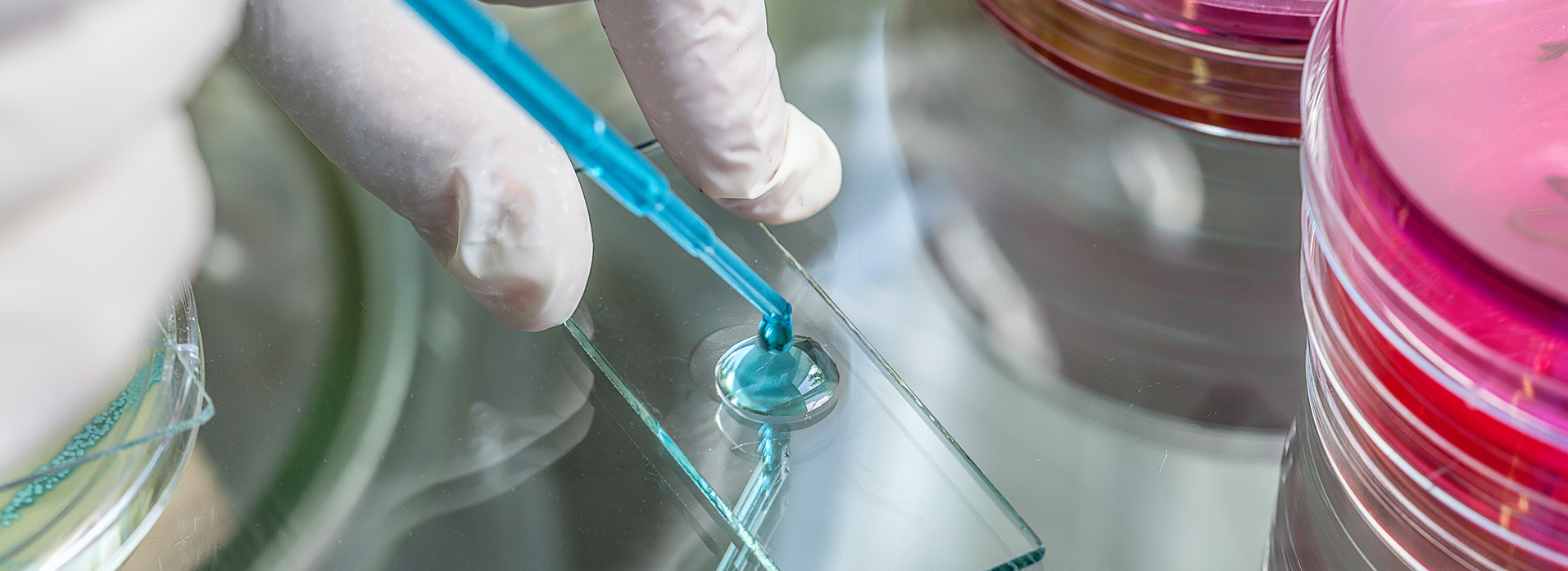 legionellenprüfung trinkwasser